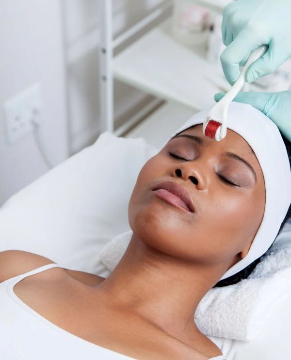 Micro needling treatment in eMalahleni